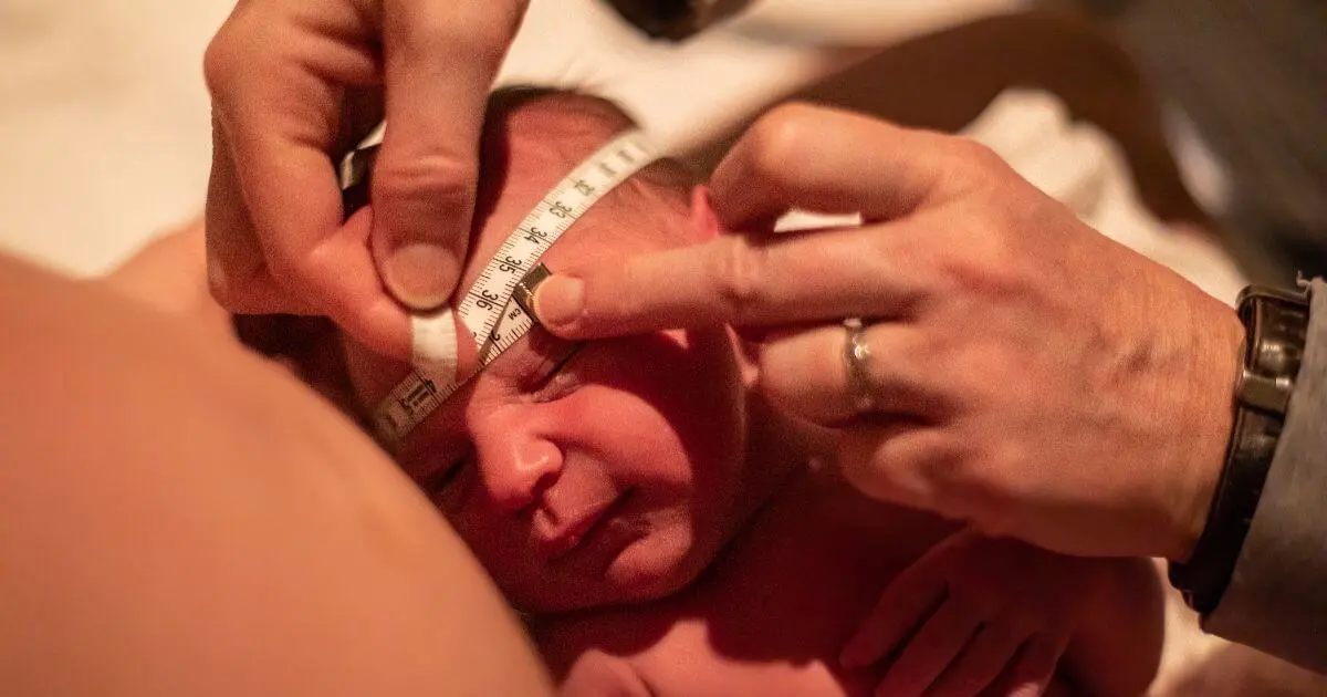 The Stages of Labor: What Really Happens During Labor and Birth? Stages of Labor image showing a newborn receiving a routine post-birth assessment and head measurement immediately after delivery.